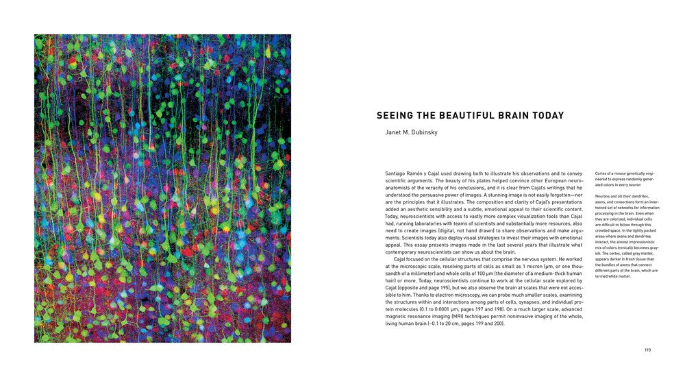 The Beautiful Brain