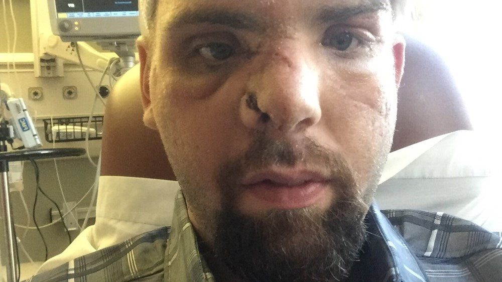 Mauled: Lessons Learned from a Grizzly Bear Attack